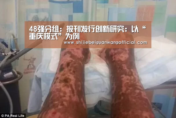 48强分组:报刊发行创新研究:以“重庆模式”为例(图1) 2026赛程